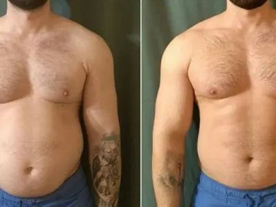 Man weight loss testimonial after using KetoVera drops